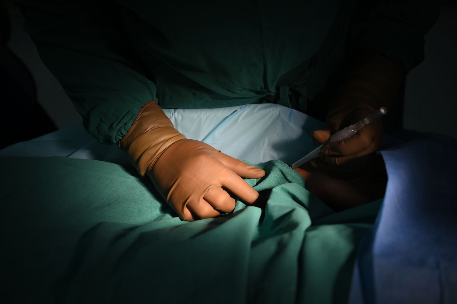 Close-up of a catheter procedure under sterile drapes